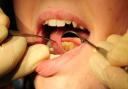 Dental services ‘at tipping point’ as surgeries turn away new patients