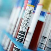 A new clinical trial is being launched as part of the battle against coronavirus